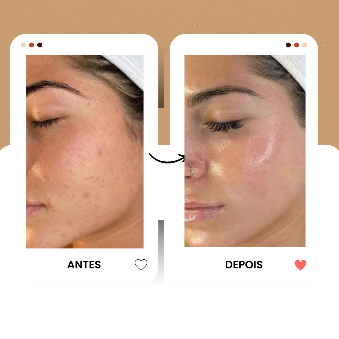 Máscara Facial de Biocolágeno BioGlow