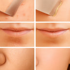 Limpador Facial Ultrasônico SkinGlow – Pele Limpa e Jovem
