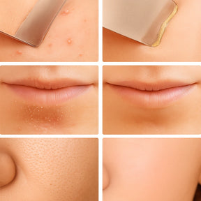 Limpador Facial Ultrasônico SkinGlow – Pele Limpa e Jovem